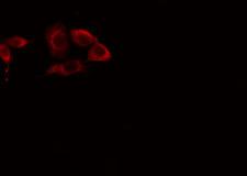 CYP39A1 Antibody - Staining LOVO cells by IF/ICC. The samples were fixed with PFA and permeabilized in 0.1% Triton X-100, then blocked in 10% serum for 45 min at 25°C. The primary antibody was diluted at 1:200 and incubated with the sample for 1 hour at 37°C. An Alexa Fluor 594 conjugated goat anti-rabbit IgG (H+L) antibody, diluted at 1/600, was used as secondary antibody.