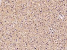 CYP39A1 Antibody - Immunochemical staining of human CYP39A1 in human liver with rabbit polyclonal antibody at 1:100 dilution, formalin-fixed paraffin embedded sections.