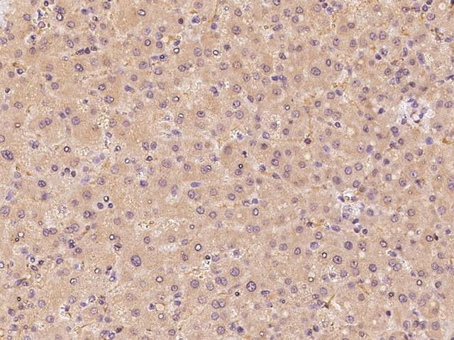 CYP39A1 Antibody - Immunochemical staining of human CYP39A1 in human liver with rabbit polyclonal antibody at 1:100 dilution, formalin-fixed paraffin embedded sections.