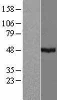 CYP39A1 Protein - Western validation with an anti-DDK antibody * L: Control HEK293 lysate R: Over-expression lysate