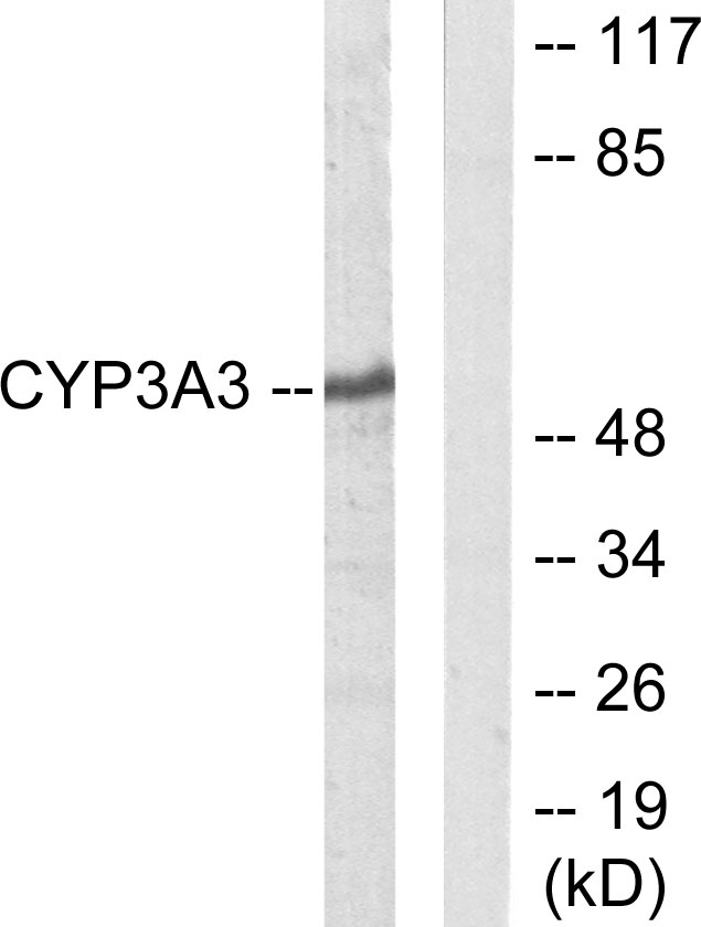 CYP3A4+5 Antibody - Western blot analysis of lysates from Jurkat cells, using Cytochrome P450 3A4/5 Antibody. The lane on the right is blocked with the synthesized peptide.