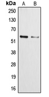 CYP3A4+5 Antibody - Western blot analysis of Cytochrome P450 3A4/5 expression in NCIH460 (A); HepG2 (B) whole cell lysates.