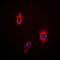 CYP3A4+5 Antibody - Immunofluorescent analysis of Cytochrome P450 3A4/5 staining in HepG2 cells. Formalin-fixed cells were permeabilized with 0.1% Triton X-100 in TBS for 5-10 minutes and blocked with 3% BSA-PBS for 30 minutes at room temperature. Cells were probed with the primary antibody in 3% BSA-PBS and incubated overnight at 4 C in a humidified chamber. Cells were washed with PBST and incubated with a DyLight 594-conjugated secondary antibody (red) in PBS at room temperature in the dark. DAPI was used to stain the cell nuclei (blue).