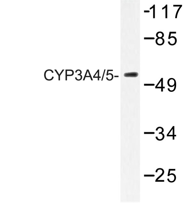 CYP3A4+5 Antibody - Western blot of CYP3A4/5 (F386) pAb in extracts from Jurkat cells.