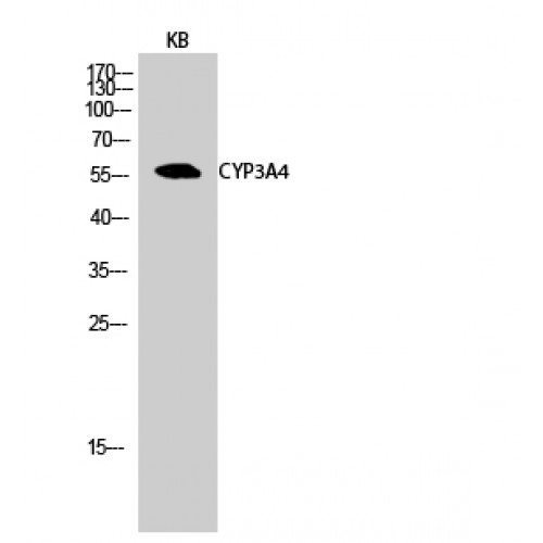 CYP3A4 / Cytochrome P450 3A4 Antibody - Western blot of CYP3A4 antibody