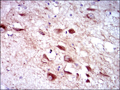 CYP3A4 / Cytochrome P450 3A4 Antibody - IHC of paraffin-embedded human brain tissues using CYP3A4 mouse monoclonal antibody with DAB staining.