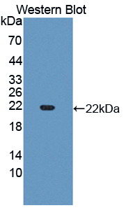CYP3A4 / Cytochrome P450 3A4 Antibody - Western blot of CYP3A4 / Cytochrome P450 3A4 antibody.