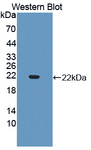 CYP3A4 / Cytochrome P450 3A4 Antibody - Western blot of CYP3A4 / Cytochrome P450 3A4 antibody.