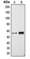 CYP3A4 / Cytochrome P450 3A4 Antibody - Western blot analysis of Cytochrome P450 3A4 expression in NCIH460 (A); human liver (B) whole cell lysates.