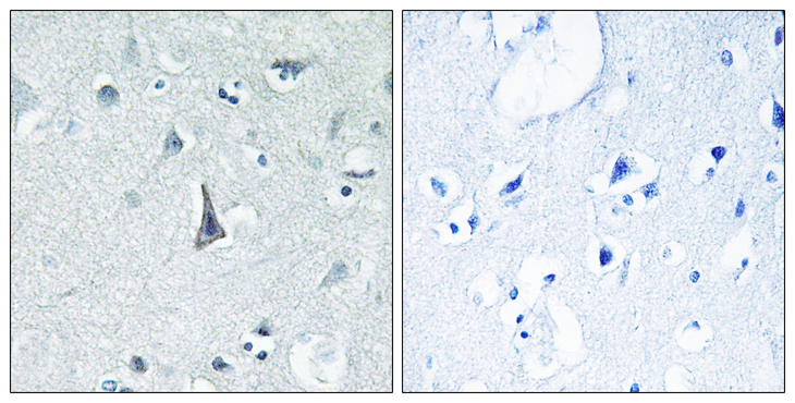 CYP3A4 / Cytochrome P450 3A4 Antibody - Immunohistochemistry of paraffin-embedded human brain tissue using Cytochrome P450 3A4 antibody.