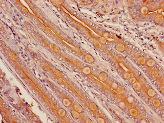 CYP3A4 / Cytochrome P450 3A4 Antibody - Immunohistochemistry of paraffin-embedded human small intestine tissue using CYP3A4 Antibody at dilution of 1:100