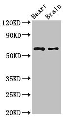 CYP3A4 / Cytochrome P450 3A4 Antibody - Western Blot Positive WB detected in: Mouse heart tissue, Mouse brain tissue All lanes: CYP3A4 antibody at 2.8µg/ml Secondary Goat polyclonal to rabbit IgG at 1/50000 dilution Predicted band size: 58 kDa Observed band size: 58 kDa