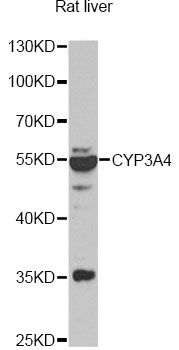 CYP3A4 / Cytochrome P450 3A4 Antibody - Western blot analysis of extracts of rat liver, using CYP3A4 antibody at 1:1000 dilution. The secondary antibody used was an HRP Goat Anti-Rabbit IgG (H+L) at 1:10000 dilution. Lysates were loaded 25ug per lane and 3% nonfat dry milk in TBST was used for blocking. An ECL Kit was used for detection and the exposure time was 90s.