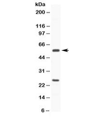 CYP3A4 / Cytochrome P450 3A4 Antibody - Western blot testing of human HeLa cell lysate with CYP3A4 antibody at 0.5ug/ml. Predicted molecular weight ~57 kDa.