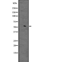 CYP3A4 / Cytochrome P450 3A4 Antibody - Western blot analysis of Cytochrome P450 3A4 expression in HEK293 cells. The lane on the left is treated with the antigen-specific peptide.