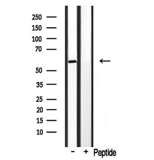CYP3A4 / Cytochrome P450 3A4 Antibody - Western blot analysis of extracts of rat brain using Cytochrome P450 3A4/5 antibody.