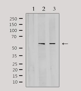 CYP3A4 / Cytochrome P450 3A4 Antibody - Western blot analysis of extracts of various samples using Cytochrome P450 3A4/5 antibody. Lane 1: HeLa treated with blocking peptide; Lane 2: HeLa; Lane 3: rat brain;