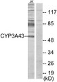 CYP3A43 Antibody - Western blot analysis of lysates from Jurkat cells, using Cytochrome P450 3A43 Antibody. The lane on the right is blocked with the synthesized peptide.