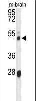 CYP3A43 Antibody - Western blot of CYP3A43 antibody in mouse brain tissue lysates (35 ug/lane). CYP3A43 (arrow) was detected using the purified antibody.
