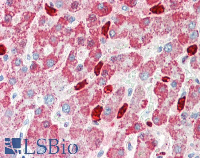 CYP3A43 Antibody - Human, Liver: Formalin-Fixed Paraffin-Embedded (FFPE).  This image was taken for the unconjugated form of this product. Other forms have not been tested.