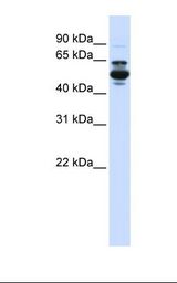CYP3A43 Antibody - Fetal liver lysate. Antibody concentration: 1.0 ug/ml. Gel concentration: 12%.  This image was taken for the unconjugated form of this product. Other forms have not been tested.