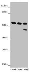 CYP3A43 Antibody - Western blot All Lanes: CYP3A43 antibody at 3.25 ug/ml Lane 1: Mouse liver tissue Lane 2: Mouse skeletal muscle tissue Lane 3: 293T whole cell lysate Secondary Goat polyclonal to rabbit IgG at 1/10000 dilution Predicted band size: 58,49,29,45 kDa Observed band size: 58,45 kDa