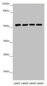 CYP3A43 Antibody - Western blot All Lanes: CYP3A43 antibody at 2.41 ug/ml Lane 1: Mouse liver tissue Lane 2: Mouse skeletal muscle tissue Lane 3: Jurkat whole cell lysate Lane 4: 293T whole cell lysate Secondary Goat polyclonal to rabbit IgG at 1/10000 dilution Predicted band size: 58,49,29,45 kDa Observed band size: 58 kDa