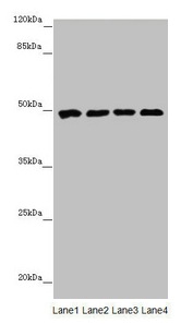 CYP3A43 Antibody - Western blot All lanes: CYP3A43 antibody at 2.41µg/ml Lane 1: Mouse liver tissue Lane 2: Mouse skeletal muscle tissue Lane 3: Jurkat whole cell lysate Lane 4: 293T whole cell lysate Secondary Goat polyclonal to rabbit IgG at 1/10000 dilution Predicted band size: 58, 49, 29, 45 kDa Observed band size: 49 kDa