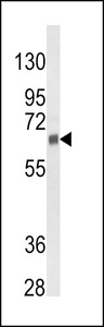 CYP3A5 Antibody - Western blot of CYP3A5 Antibody in 293 cell line lysates (35 ug/lane). CYP3A5 (arrow) was detected using the purified antibody.