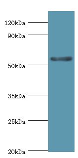 CYP3A5 Antibody - Western blot. All lanes: Cytochrome P450 3A5 antibody at 9 ug/ml+mouse liver tissue Goat polyclonal to rabbit at 1:10000 dilution. Predicted band size: 57 kDa. Observed band size: 57 kDa Immunohistochemistry.