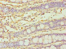 CYP3A5 Antibody - Immunohistochemistry of paraffin-embedded human rectum using antibody at 1:100 dilution.
