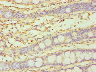 CYP3A5 Antibody - Immunohistochemistry of paraffin-embedded human colon tissue using CYP3A5 Antibody at dilution of 1:100