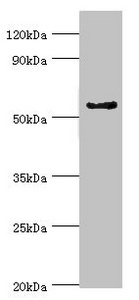 CYP3A5 Antibody - Western blot All lanes: Cytochrome P450 3A5 antibody at 9µg/ml + Mouse liver tissue Secondary Goat polyclonal to rabbit IgG at 1/10000 dilution Predicted band size: 58, 16 kDa Observed band size: 58 kDa