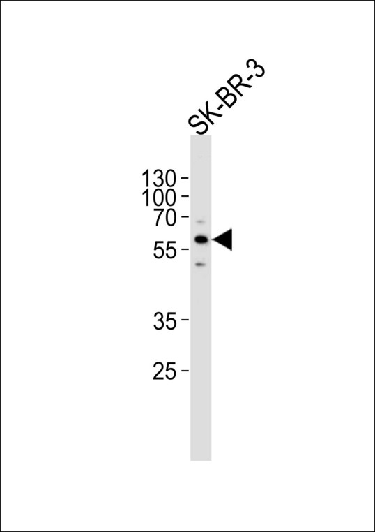 CYP3A5 Antibody - Western blot of lysate from SK-BR-3 cell line, using CYP3A5 Antibody. Antibody was diluted at 1:1000. A goat anti-rabbit IgG H&L (HRP) at 1:5000 dilution was used as the secondary antibody. Lysate at 35ug.