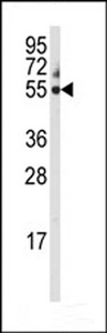 CYP3A5 Antibody - Western blot of anti-CYP3A5 Antibody in 293 cell line lysates (35 ug/lane). CYP3A5 (arrow) was detected using the purified antibody.