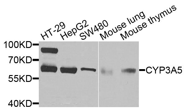 CYP3A5 Antibody - Western blot analysis of extracts of various cells.