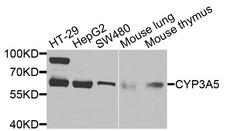 CYP3A5 Antibody - Western blot analysis of extracts of various cells.