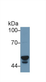 CYP3A7 Antibody - Western Blot; Sample: Human Liver lysate; Primary Ab: 1µg/ml Rabbit Anti-Human CYP3A7 Antibody Second Ab: 0.2µg/mL HRP-Linked Caprine Anti-Rabbit IgG Polyclonal Antibody