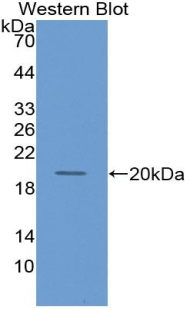 CYP3A7 Antibody - Western blot of recombinant CYP3A7.