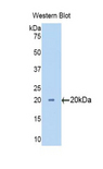 CYP3A7 Antibody - Western blot of recombinant CYP3A7.  This image was taken for the unconjugated form of this product. Other forms have not been tested.