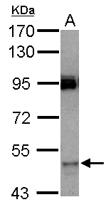 CYP3A7 Antibody - Sample (30 ug of whole cell lysate) A: HeLa 7.5% SDS PAGE CYP3A7 antibody diluted at 1:1000