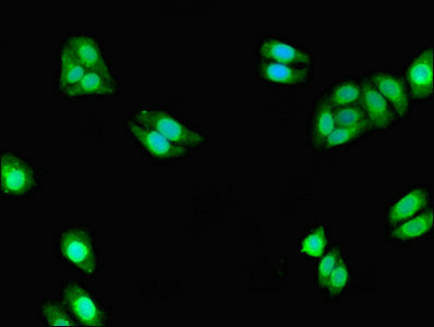 CYP3A7 Antibody - Immunofluorescent analysis of HepG2 cells using CYP3A7 Antibody at dilution of 1:100 and Alexa Fluor 488-congugated AffiniPure Goat Anti-Rabbit IgG(H+L)