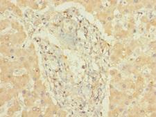 CYP3A7 Antibody - Immunohistochemistry of paraffin-embedded human liver tissue using CYP3A7 Antibody at dilution of 1:100
