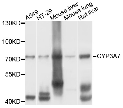 CYP3A7 Antibody - Western blot analysis of extracts of various cell lines, using CYP3A7 antibody at 1:1000 dilution. The secondary antibody used was an HRP Goat Anti-Rabbit IgG (H+L) at 1:10000 dilution. Lysates were loaded 25ug per lane and 3% nonfat dry milk in TBST was used for blocking. An ECL Kit was used for detection and the exposure time was 5s.