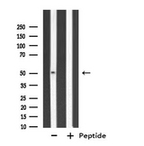 CYP3A7 Antibody - Western blot analysis of extracts of LOVO cells using Cytochrome P450 3A7 antibody.