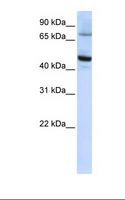 CYP46A1 / CYP46 Antibody - HepG2 cell lysate. Antibody concentration: 1.0 ug/ml. Gel concentration: 12%.  This image was taken for the unconjugated form of this product. Other forms have not been tested.