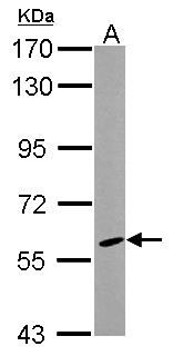 CYP46A1 / CYP46 Antibody - Sample (30 ug of whole cell lysate) A: MCF-7 7.5% SDS PAGE CYP46A1 antibody diluted at 1:1000