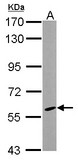 CYP46A1 / CYP46 Antibody - Sample (30 ug of whole cell lysate) A: MCF-7 7.5% SDS PAGE CYP46A1 antibody diluted at 1:1000
