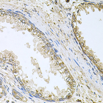 CYP46A1 / CYP46 Antibody - Immunohistochemistry of paraffin-embedded human prostate.