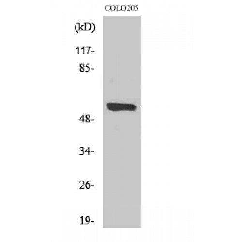CYP4A11+22 Antibody - Western blot of CYP4A11/22 antibody